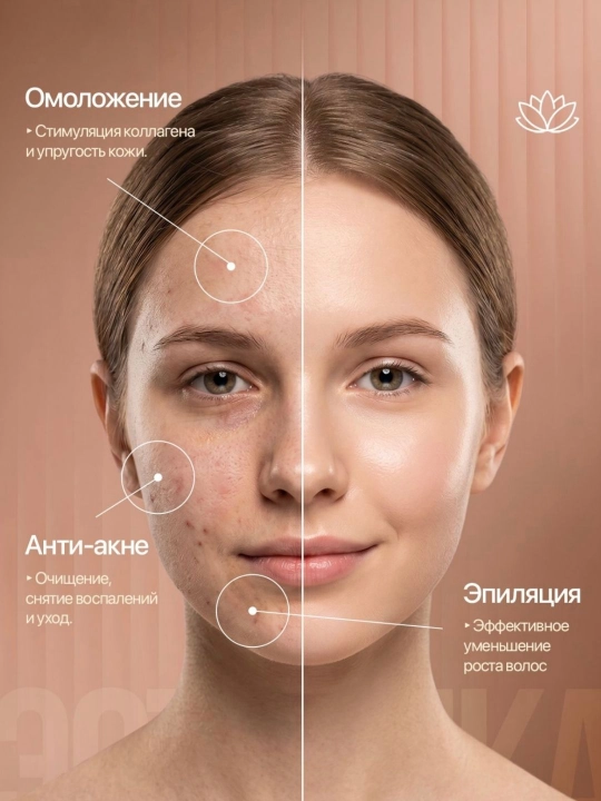 Babyverse Professional fotoepilyator, yuz va tana uchun, sovutish effektiga ega
