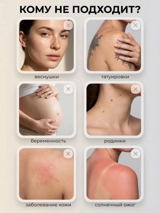 Babyverse Professional fotoepilyator, yuz va tana uchun, sovutish effektiga ega