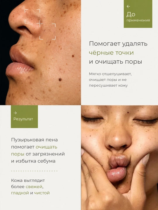 Пузырьковая маска для лица HUNMUI с авокадо от чёрных точек 5 г × 12 шт