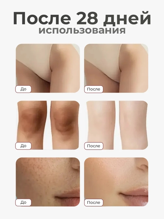 Niatsinamid loson, tana uchun krem, oqartiruvchi loson, tana parvarishi, namlovchi krem