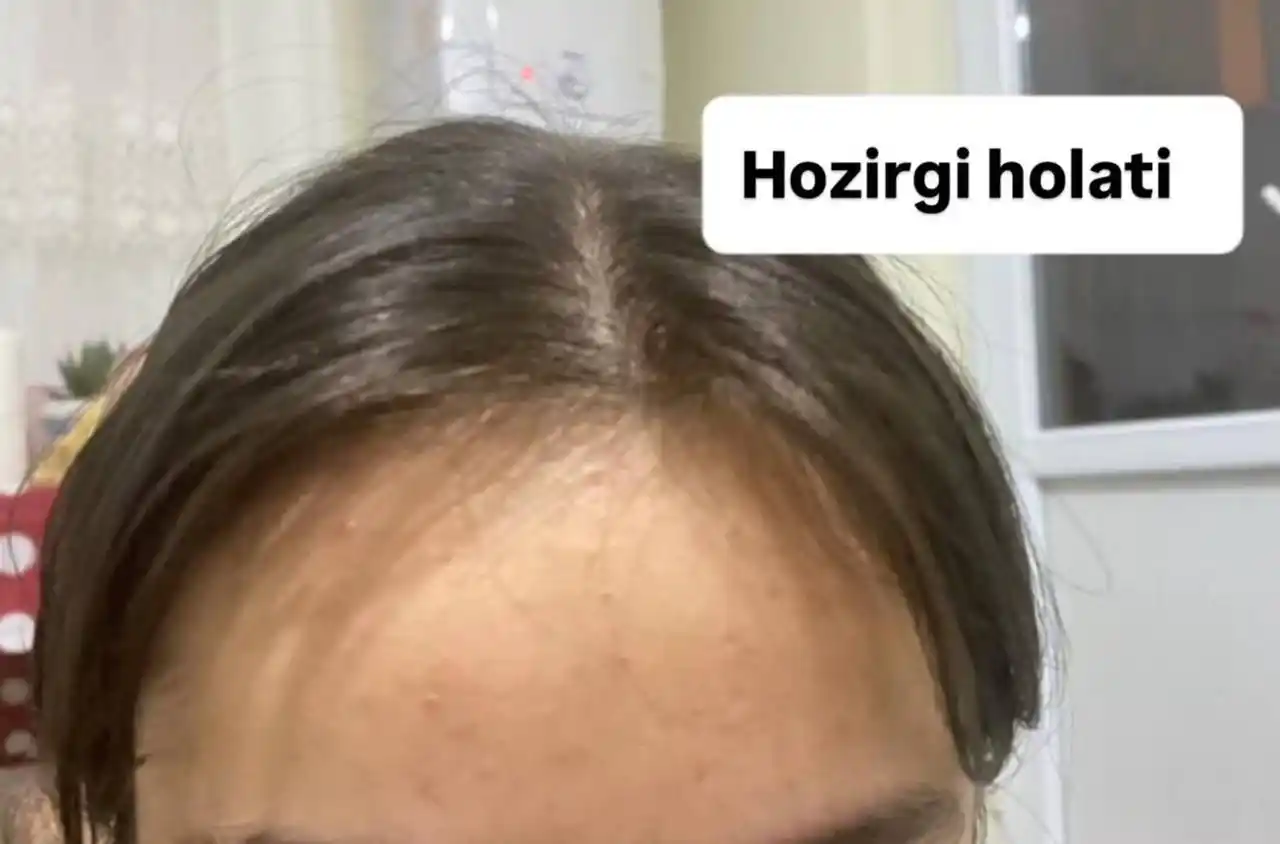 Натуральный шампунь без сульфатов, который укрепляет волосы и предотвращает их выпадение.