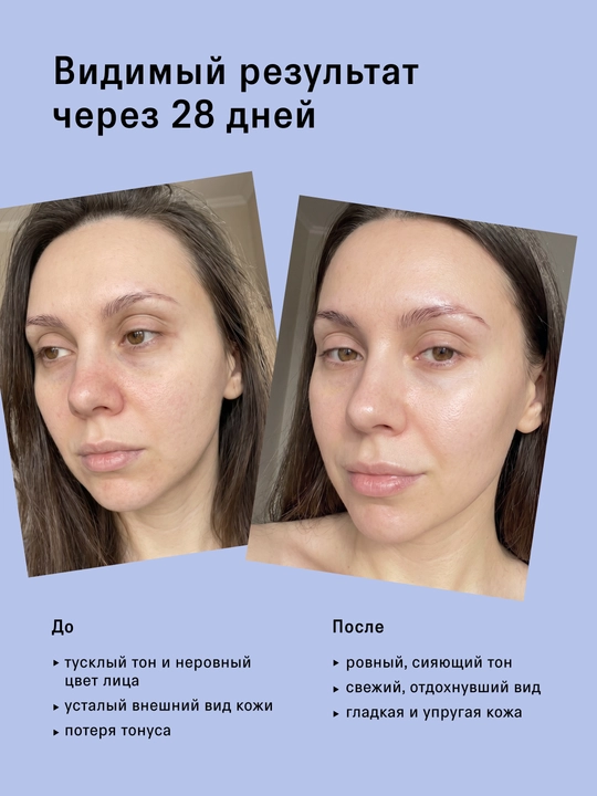 Набор для лица, сыворотка кислотная, ночная, с пробиотиками, с церамидами, антиоксидантная