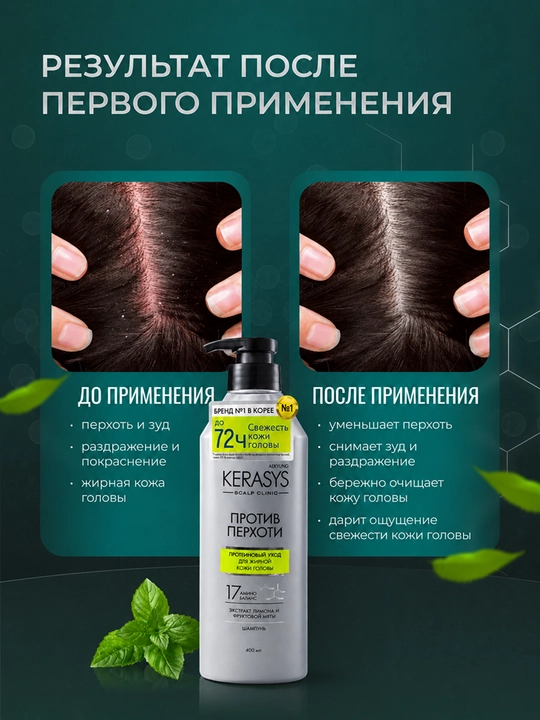 Kerasys erkaklar va ayollar shampuni qazg‘oqqa qarshi yog‘li sochlar uchun, 400 ml, Koreya