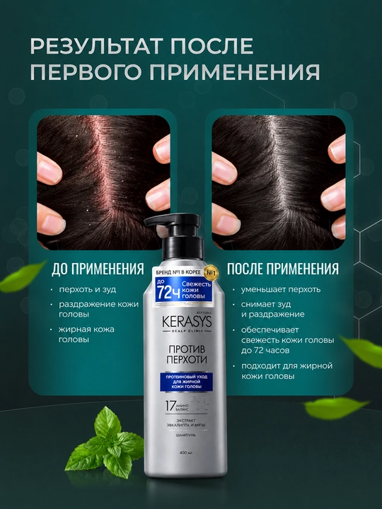 Kerasys erkaklar va ayollar shampuni qazg‘oqqa qarshi yog‘li sochlar uchun, 400 ml, Koreya