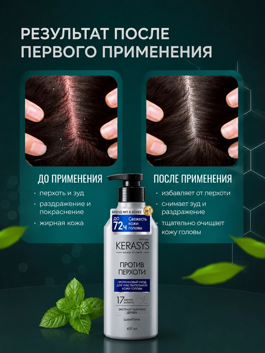 Kerasys erkaklar va ayollar shampuni qazg‘oqqa qarshi yog‘li sochlar uchun, 400 ml, Koreya