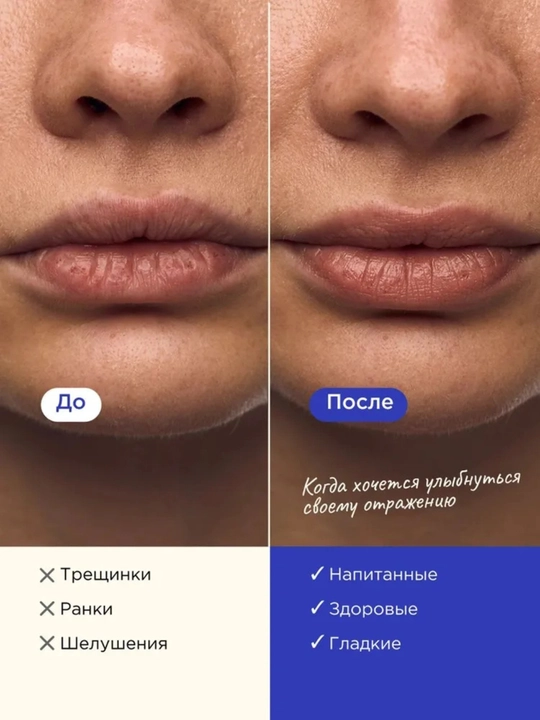 Маска для губ, бальзам для губ, уход за губами, витамин Е, увлажнение губ