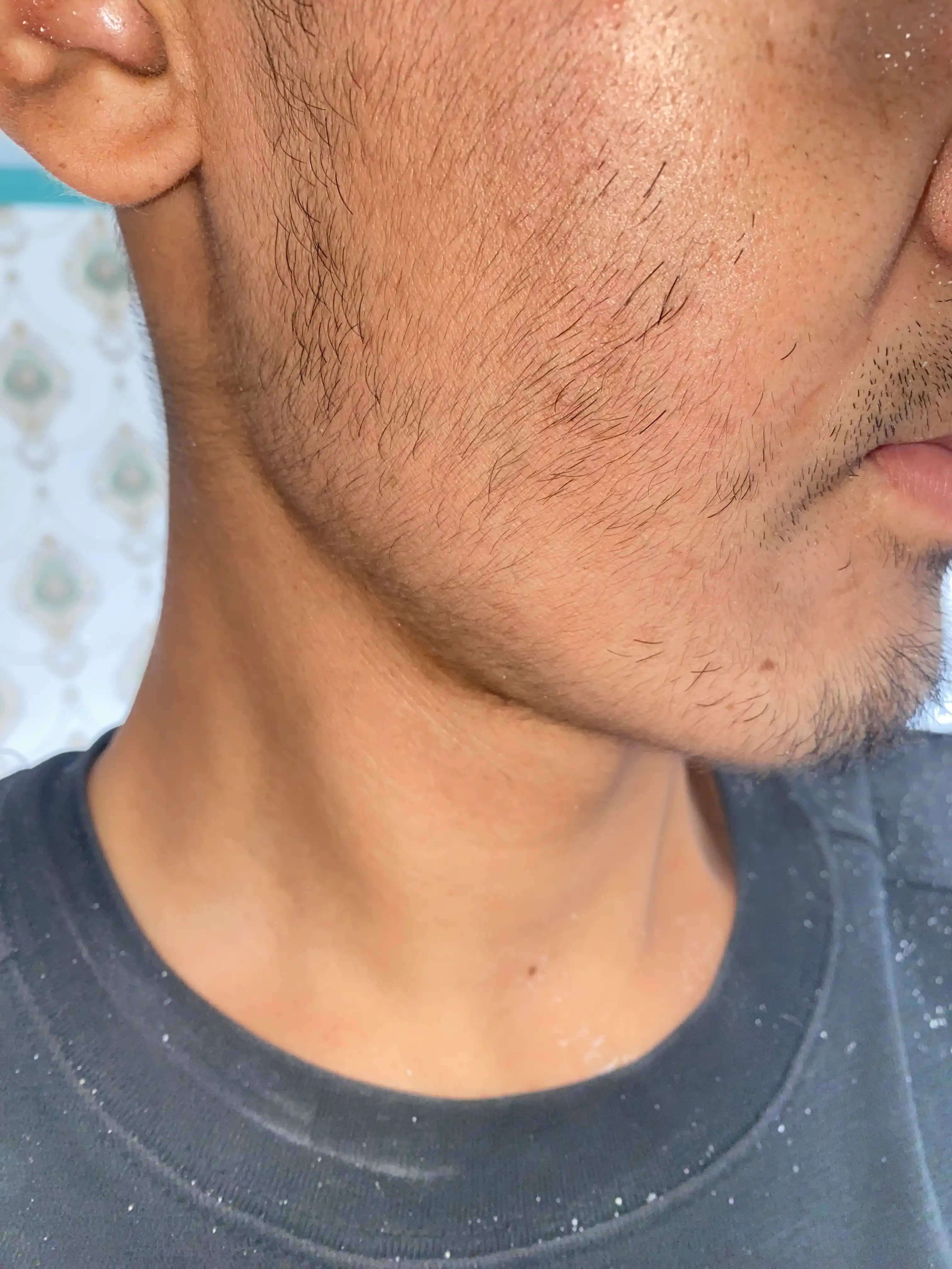 Soch va soqol o'stirish uchun minoksidil Kirkland Minoxidil 5%, 60 ml