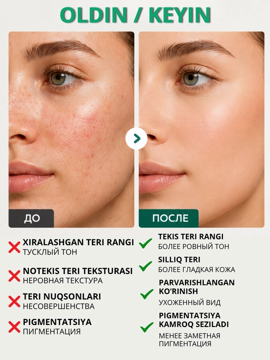 Azelain kislotali yuz krem-geli Compliment muammoli va yog‘li teri uchun, 35 ml