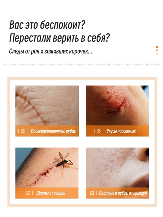 Крем от шрамов рубцов и растяжек для тела LYDIMOON мазь от следов акне и постакне