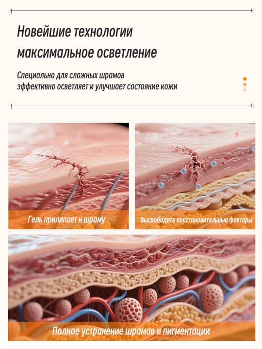 Крем от шрамов рубцов и растяжек для тела LYDIMOON мазь от следов акне и постакне