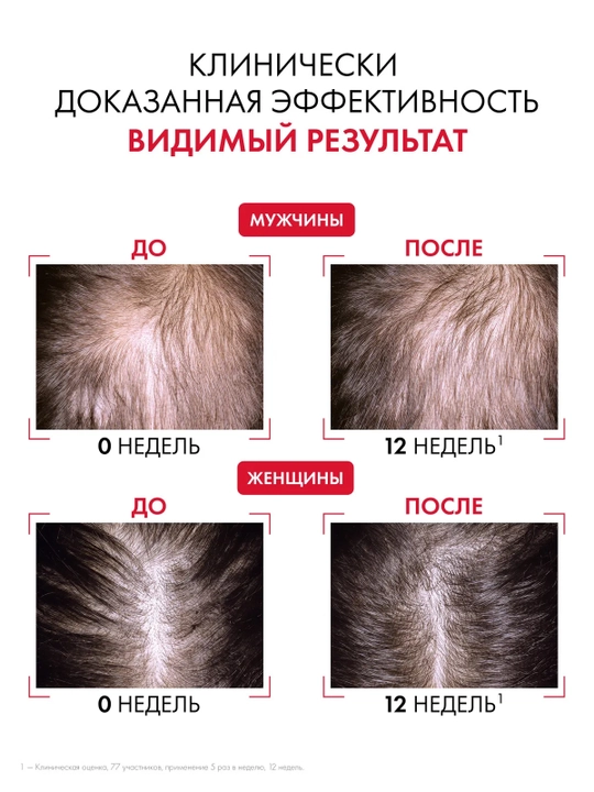 VICHY Dercos Aminexil Сыворотка для укрепления и роста волос 90 мл
