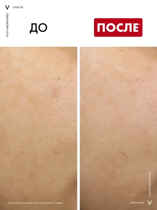 VICHY Liftactiv B3 Pigmentatsiya va ajinlarga qarshi retinolli tungi yuz kremi 50 ml