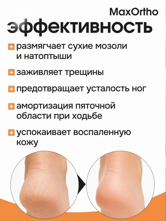 To'piqlar va yorilgan poshnalar uchun silikon poshna prokladkalari - 2 dona, namlovchi
