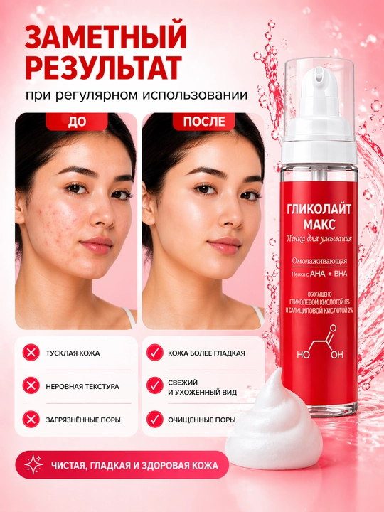 Пенка для умывания ГЛИКОЛАЙТ МАКС, 200 мл