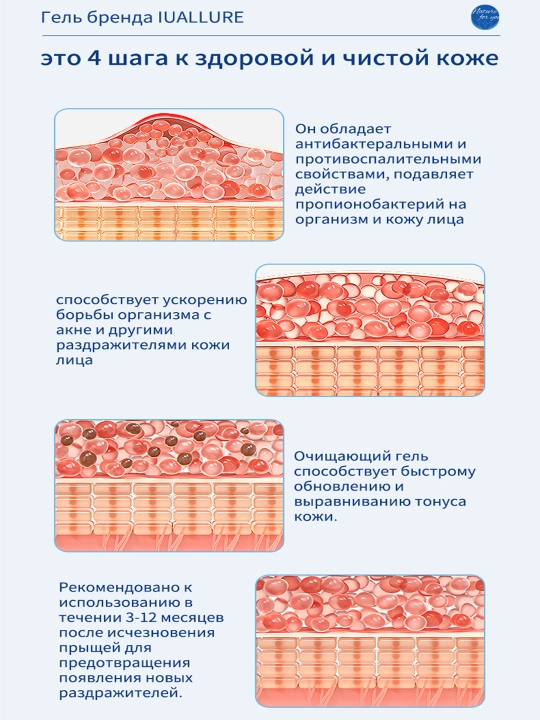 Гель от прыщей и акне IUALLURE, алоэ вера, точечный крем для проблемной кожи лица, 20 мл