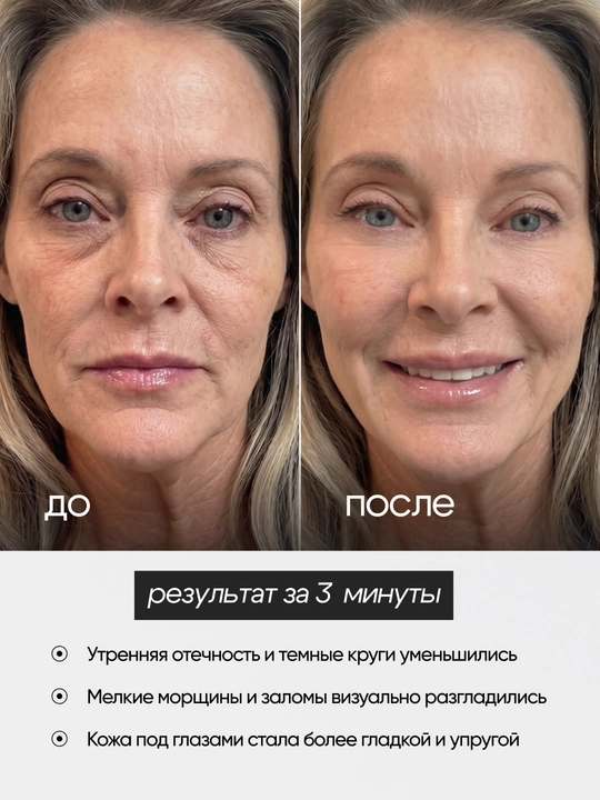 Erkaklar va ayollar uchun shish, mayda ajinlar va ko‘z atrofidagi teri uchun krem