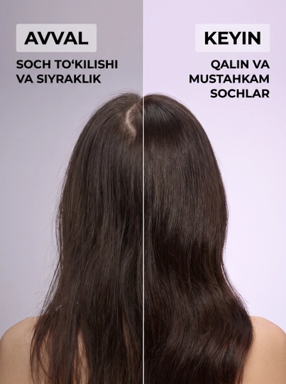 Dr.Rooteer Kerasys ayollar va erkaklar uchun soch to‘kilishi va qazg‘oqqa qarshi shampun, 800 ml