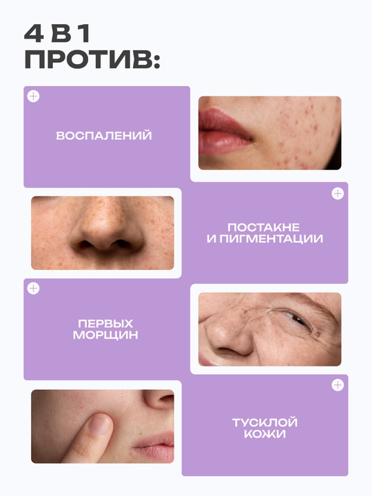 Крем The U Glow Skin Retinol Cream, содержащий 0,3% ретинола и бакучиол для ухода за кожей