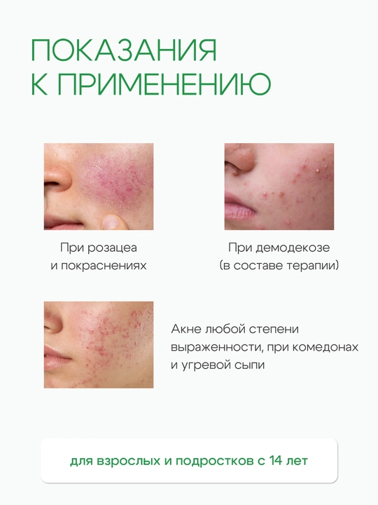 Гельтек Гель для лица от прыщей, розацеа и демодекоза Демотен