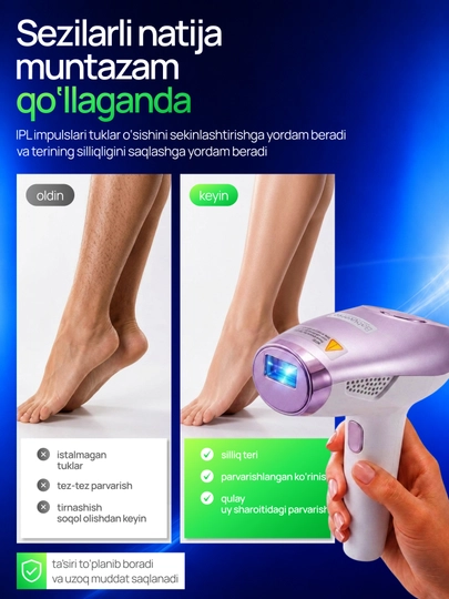 Фотоэпилятор IPL лазерный Babyverse SE10, с охлаждением для лица и тела