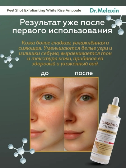 Сыворотка для лица Dr.Melaxin Peel Shot Exfoliating с экстрактом белого риса, 80 мл