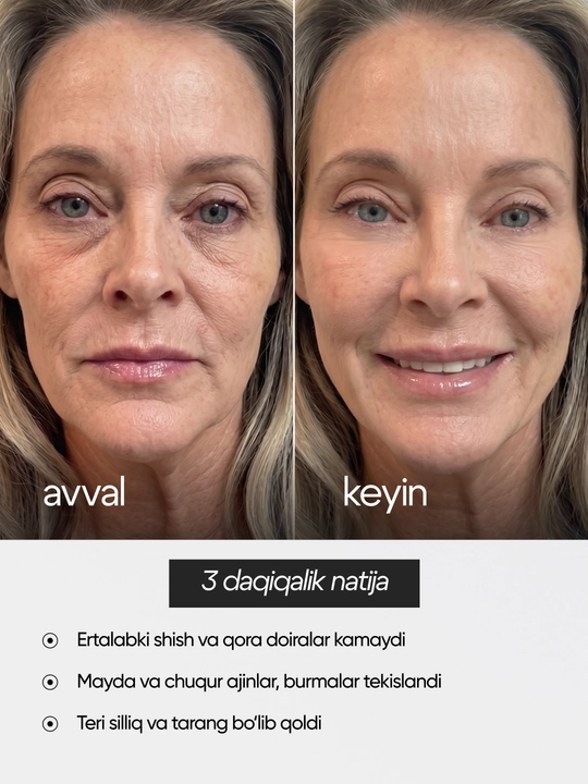 Erkaklar va ayollar uchun shish, mayda ajinlar va ko‘z atrofidagi teri uchun krem
