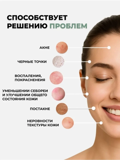 Крем против угревой сыпи BIOAQUA с салициловой кислотой, 20 г