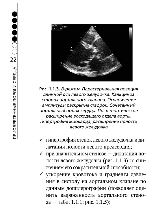 Пороки Сердца