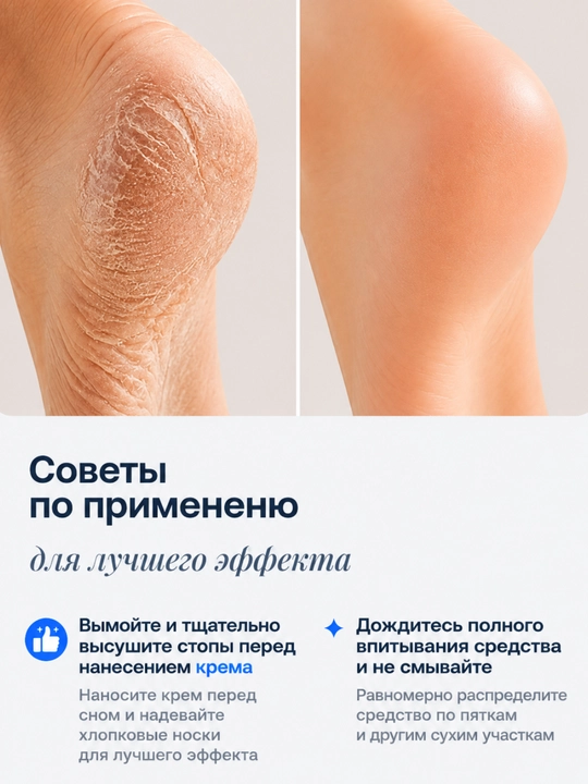 NeoNea Skin Care Advanced Foot Treatment — крем для ухода за кожей стоп