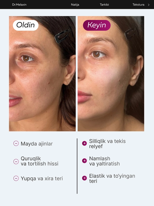 Стик-бальзам для лица Dr.Melaxin Cemenrete Calcium Volume Multi Balm, от морщин