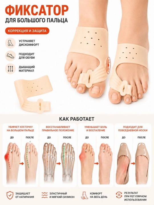 Oyoq bosh barmog‘i uchun silikon fiksator, Hallux Valgus suyakchasi korrektori