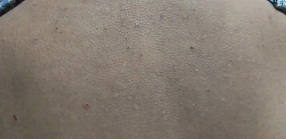 Сыворотка для лица The Ordinary Niacinamide 10% + Zinc 1%, 30 мл