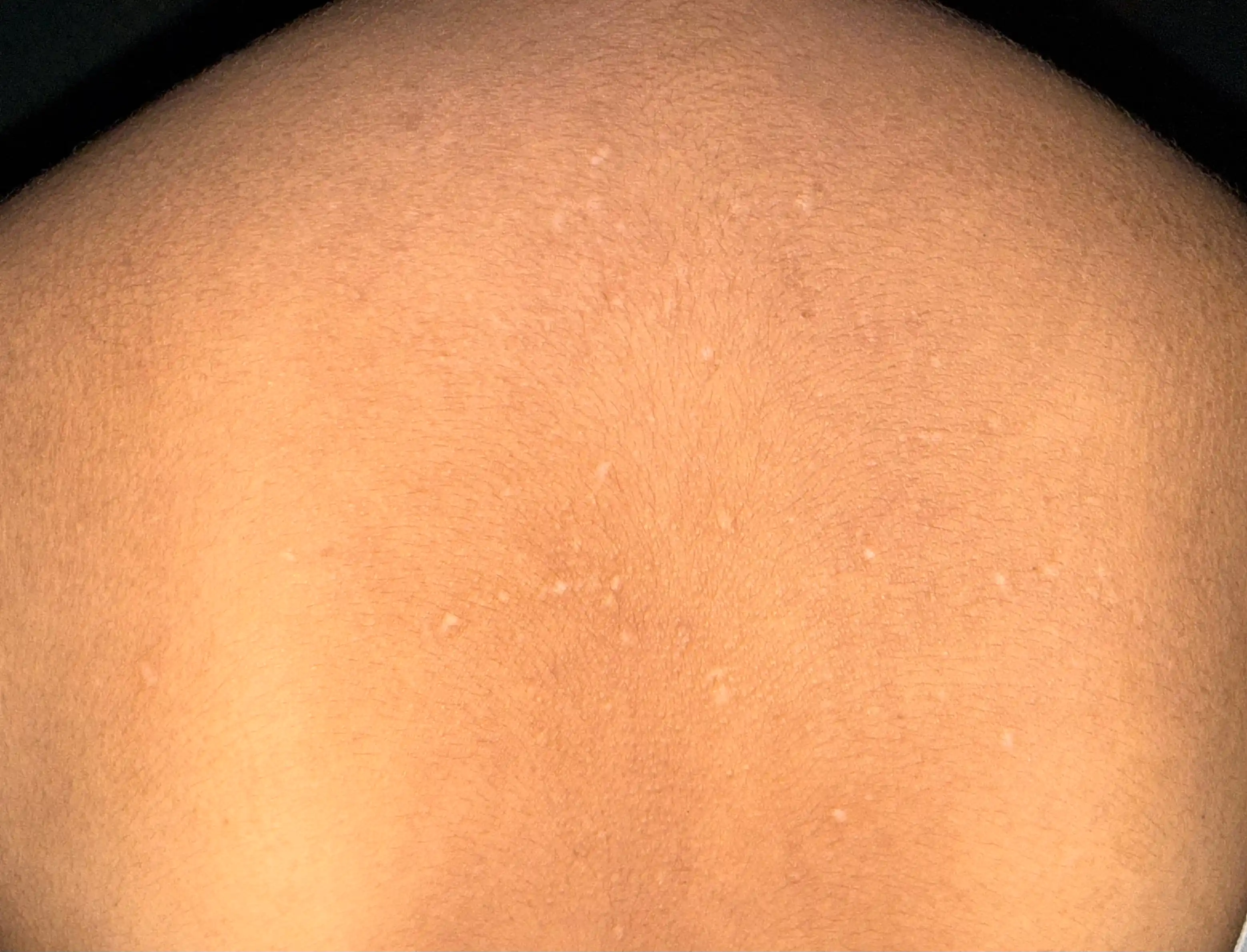 Сыворотка для лица The Ordinary Niacinamide 10% + Zinc 1%, 30 мл