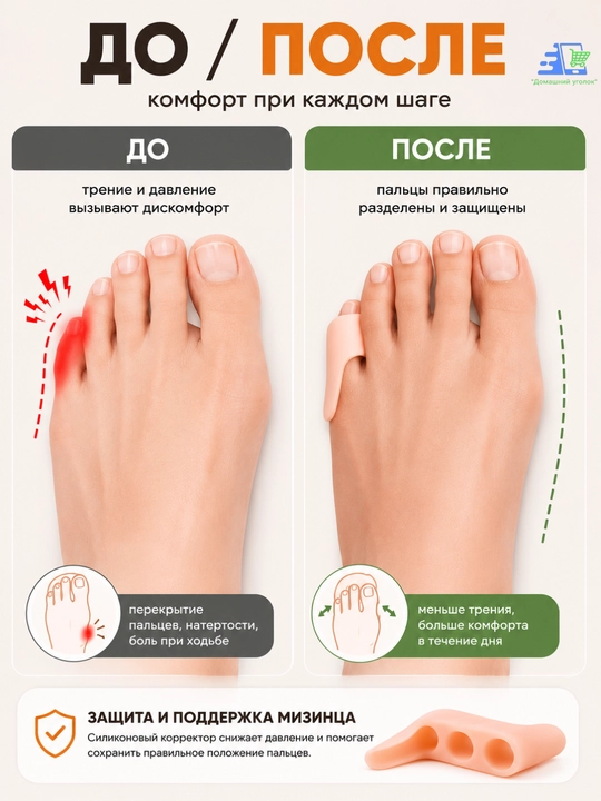 Корректор мизинца силиконовый 3 в 1, разделитель пальцев, 2 шт