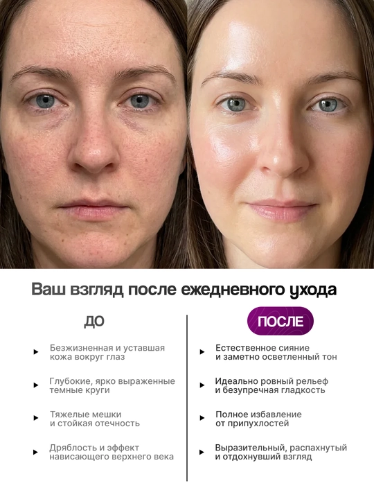 Крем для кожи вокруг глаз Dr. Melaxin Calcium Dark Spot Eye Cream от морщин, 15 г