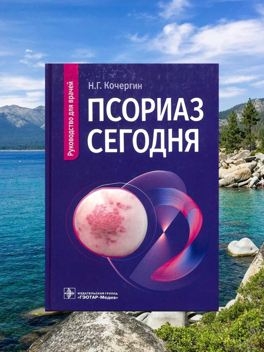 Psoriaz bugun – Psoriazni tashxislash va davolash bo'yicha tibbiy qo'llanma  - 