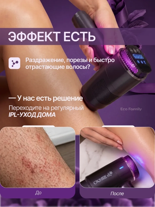 Фотоэпилятор CRONIER для домашнего использования, лазерный эпилятор