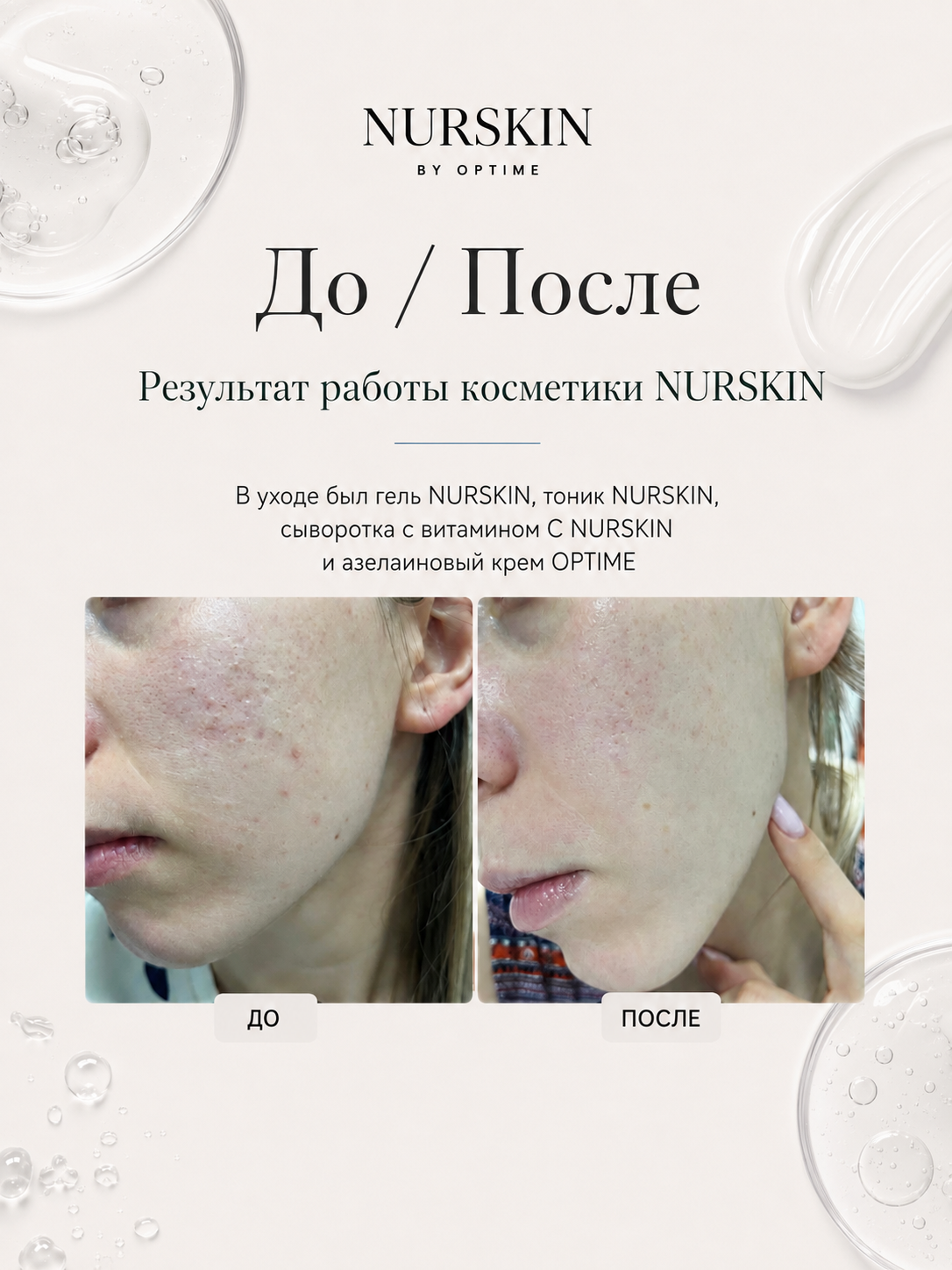 Увлажняющий тоник NURSKIN by Optime