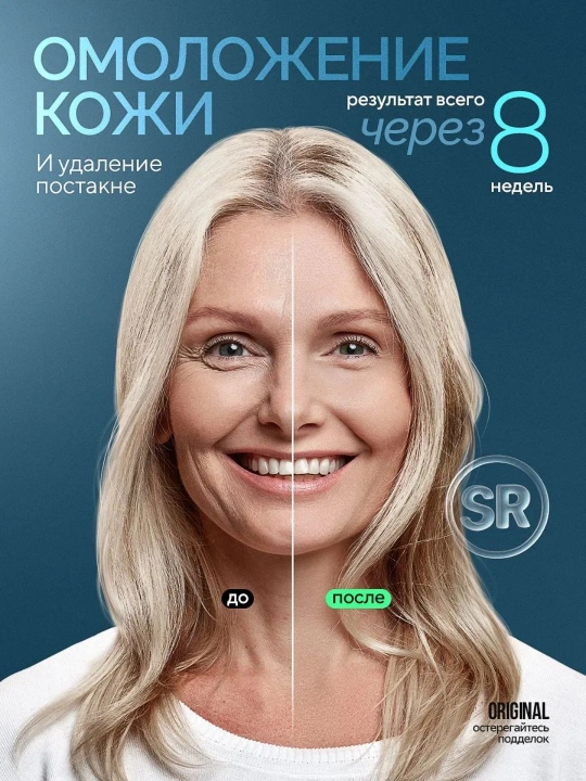 Babyverse Professional fotoepilyator, yuz va tana uchun, sovutish effektiga ega