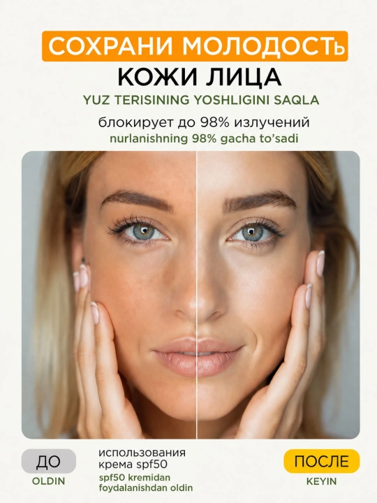 MIXIT Moisturizing Body & Face Cream yuz va tana uchun quyoshda qorayishdan keyingi namlantiruvchi krem, 150 ml