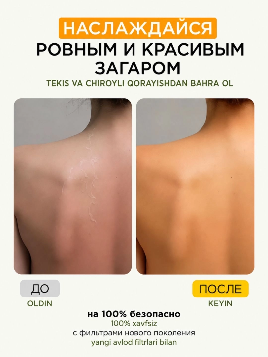 MIXIT Moisturizing Body & Face Cream yuz va tana uchun quyoshda qorayishdan keyingi namlantiruvchi krem, 150 ml
