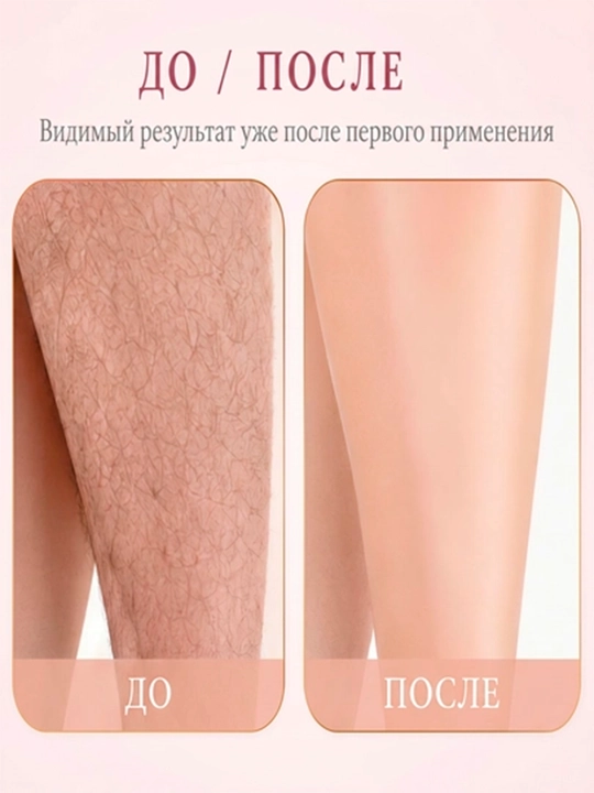 Крем для депиляции Fengma, 150 г, для удаления волос