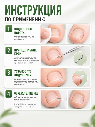 Корректор и вставки для коррекции вросшего ногтя, набор кюретка и подушечки