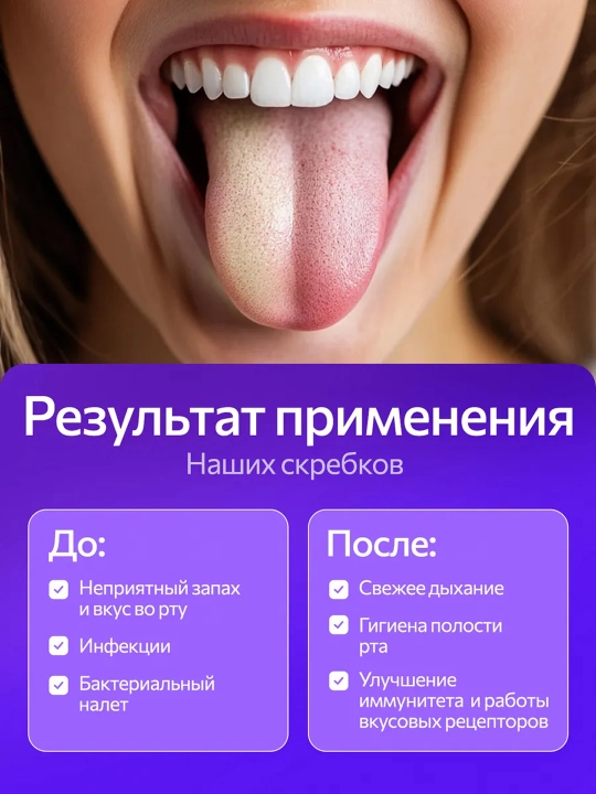 Blyashka va hiddan himoya qiluvchi til qirg‘ichi