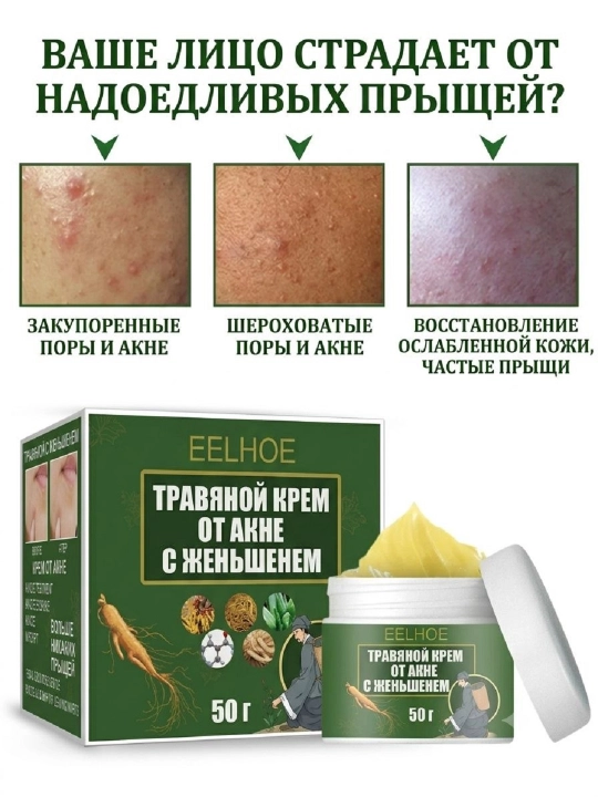 Akne, aknedan keyingi izlar va qizarishga qarshi tozalovchi o‘simlikli yuz kremi, 50 g