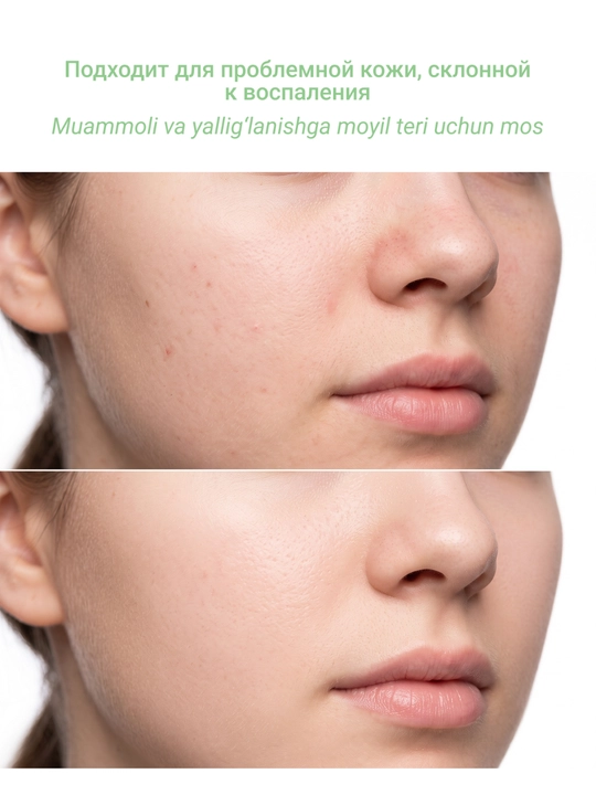 DR.PLINUS Z aknega qarshi yuvinish uchun tozalovchi ko‘pik Acne Cleanser, 150 ml