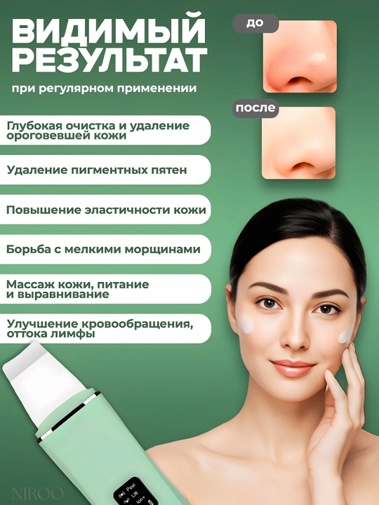 Ультразвуковой аппарат для чистки лица пилинг, массаж, лифтинг, удаление чёрных точек 4в1