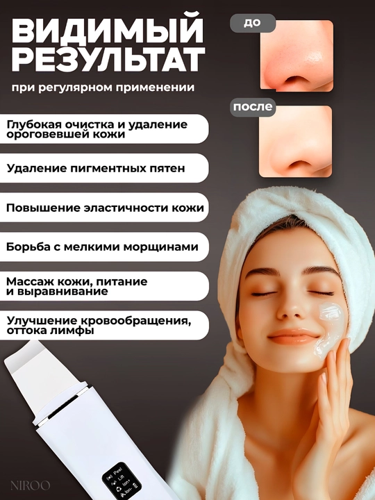 Ультразвуковой аппарат для чистки лица пилинг, массаж, лифтинг, удаление чёрных точек 4в1