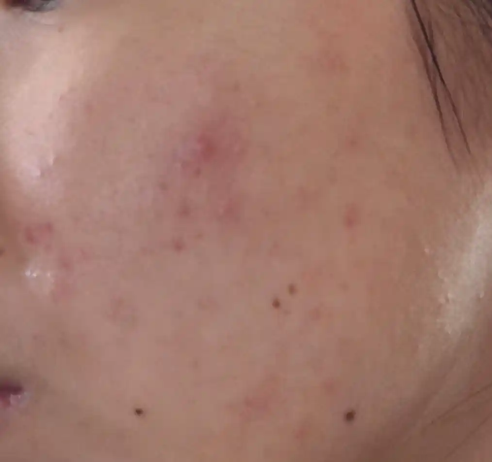 Пенка с салициловой кислотой для проблемной кожи, COSRX Salicylic Acid Cleanser, 150 мл