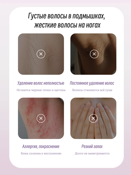 Спрей для депиляции и удаления волос LYDIMOON без боли, для ног, подмышек, бикини, 150 мл